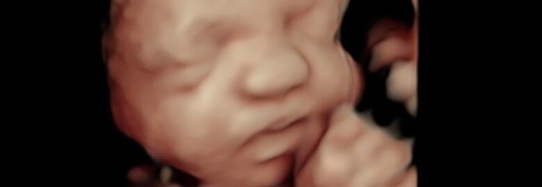 Desired Dream Ultrasound